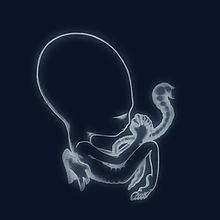 AgætisByrjunCover